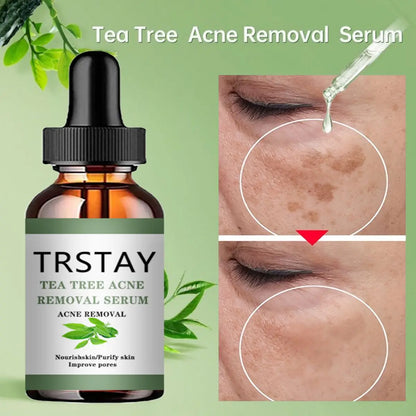 Glow - KoreanCare, Tree-Serum / Gegen Akne